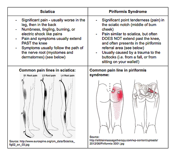 sciatic nerve roots