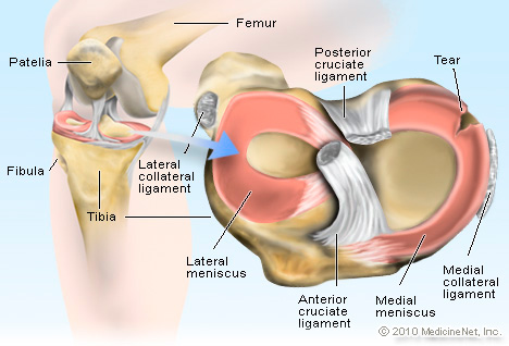 ACL Vs MCL Tear: Understanding The Difference - Saqsham Ortho