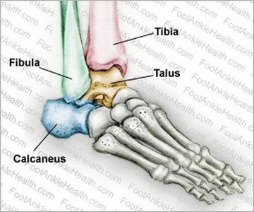 Broken Ankle  PhysioRoom Advice