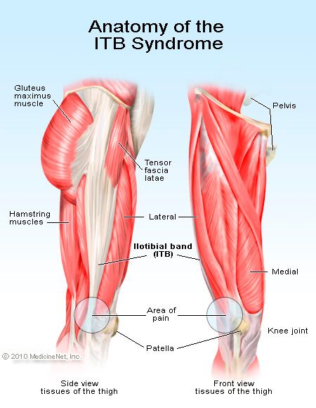 Think your IT band is tight or sore? Its probably because of your gluteus  medius. : r/Fitness