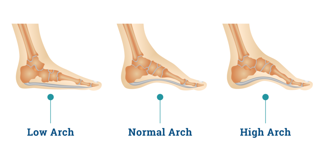 You’ve been told you have flat feet. Now what?