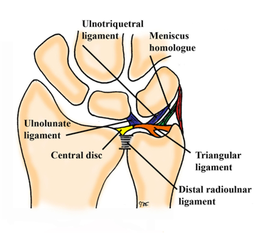 TFCC Injury & Irritation: Triangular Fibrocartilage Complex