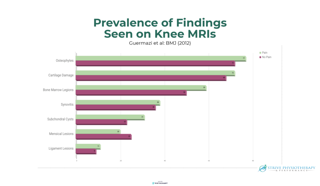 knee mris