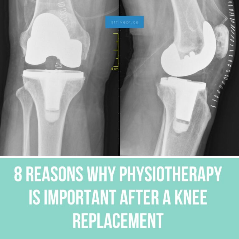 is physiotherapy important after a knee replacement