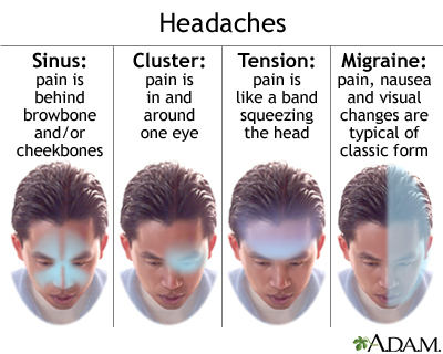physiotherapy for headache