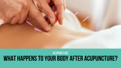acupuncture