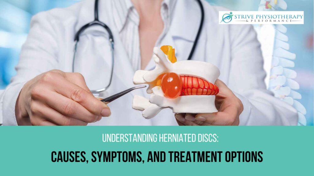 Herniated Discs  PhysioMax Wellness - Burlington Physiotherapy Clinic