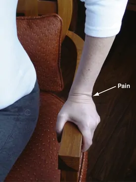 TFCC injury symptoms